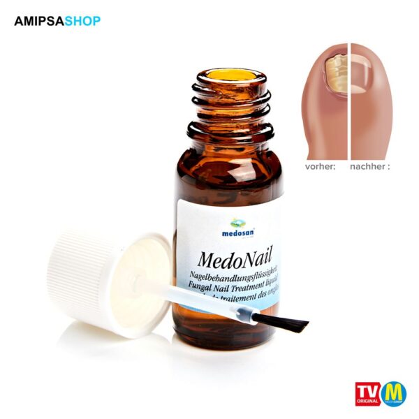 medosan MedoNail gegen Nagelpilz 10ml